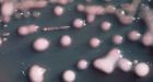 Concerns after outbreak of superbug in 2 Ontario hospitals